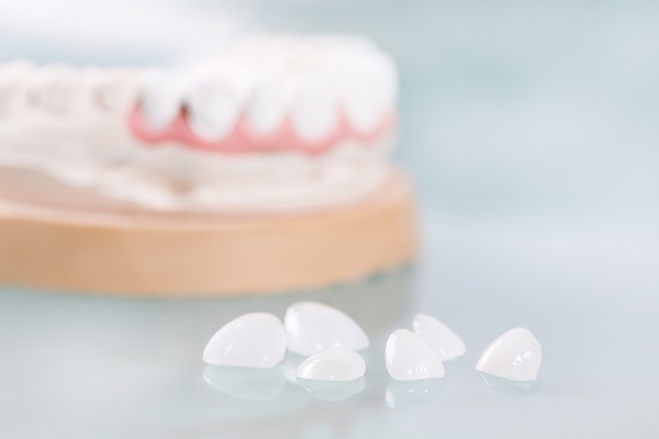 A Cosmetic Dentist Goes Over The Different Types Of Veneers