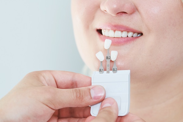 The Process Of Getting Dental Veneers With A Cosmetic Dentist