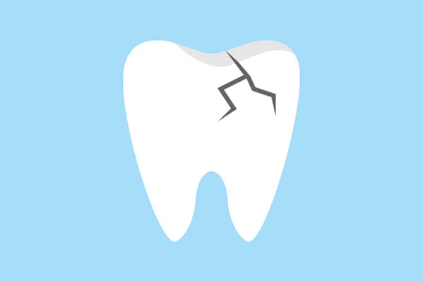 Ask an Implant Dentist About Replacing a Damaged Tooth from Aesthetic Dentistry of Noe Valley in San Francisco, CA
