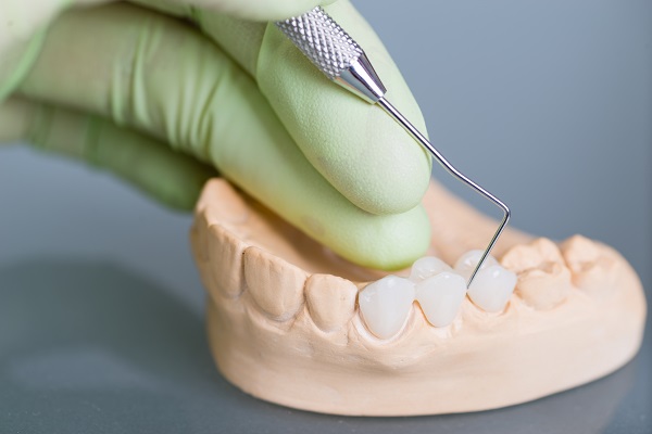 Why Are Dental Crowns So Popular With Cosmetic Dentists?