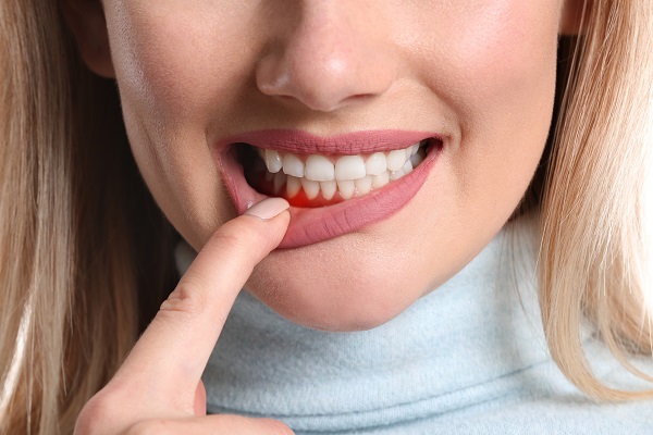 Does Gum Disease Put The Entire Body At Risk?