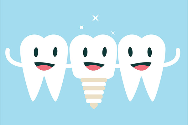 Implant Dentistry Aftercare FAQs from Aesthetic Dentistry of Noe Valley in San Francisco, CA