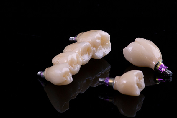 Implant Dentistry Options For Multiple Missing Teeth