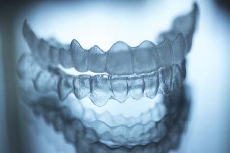 Answers To Questions About Invisalign Treatments For Adults