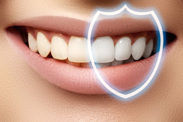 Does Teeth Bleaching Take More Than One Visit?