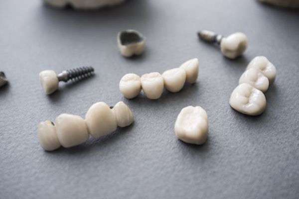 Types of Dental Implants from Aesthetic Dentistry of Noe Valley in San Francisco, CA